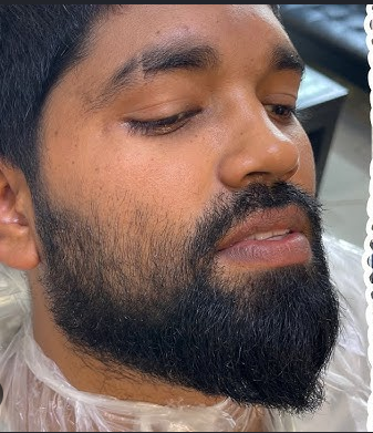 After grooming treatment